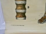 Large University Anatomical Chart “Ligamnets” By Turner photo 678.0