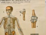 Large University Anatomical Chart “Ligamnets” By Turner photo vinterior